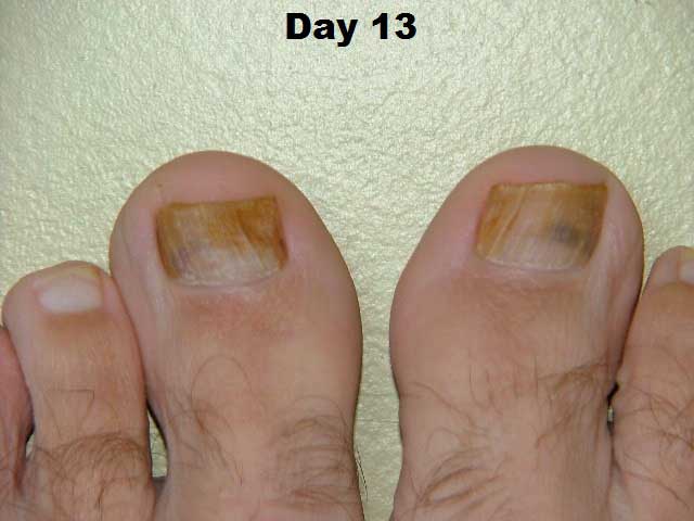 day 13