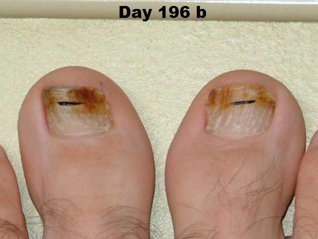 day196b