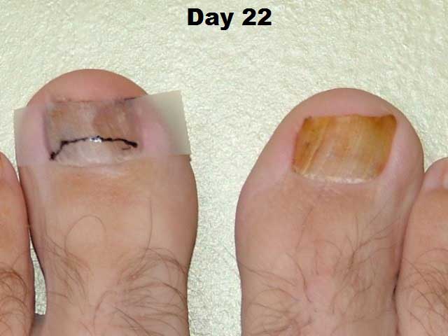 day 22