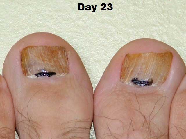 day 23