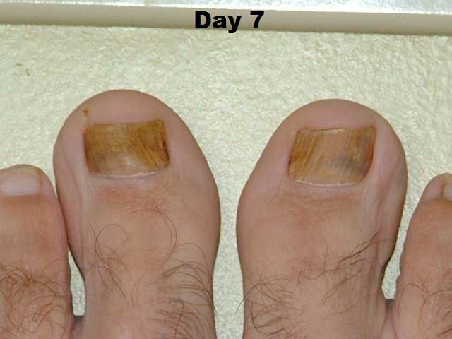 Day 7